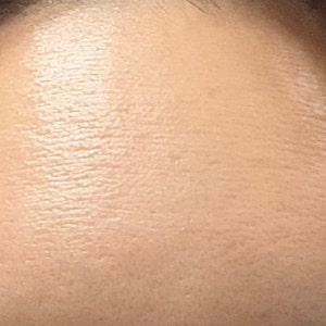세종 스킨보톡스 효과 없어서 피부과 3곳에 전화해 봤다 | 25 vs 50 vs 150유닛