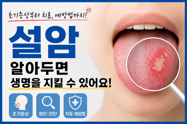 [톨이정보통] 구강암(설암) 초기 증상부터 원인 •치료 방법까지 알아보기