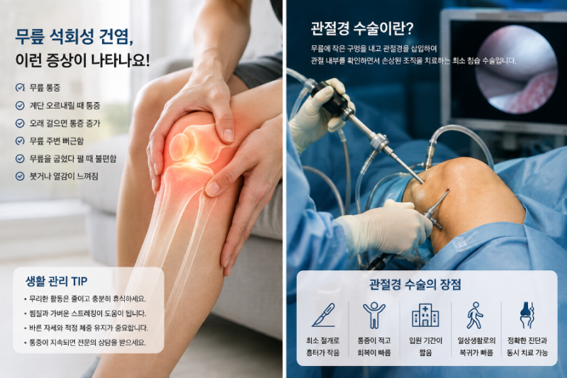 "무릎에 생긴 석회, 그냥 두어도 될까? 석회성 건염과 무릎 석회화, 증상부터 검사·치료·관....