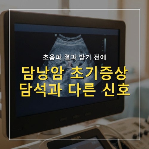 담낭암 초기증상, 담석과 헷갈리기 쉬운 신호 5가지