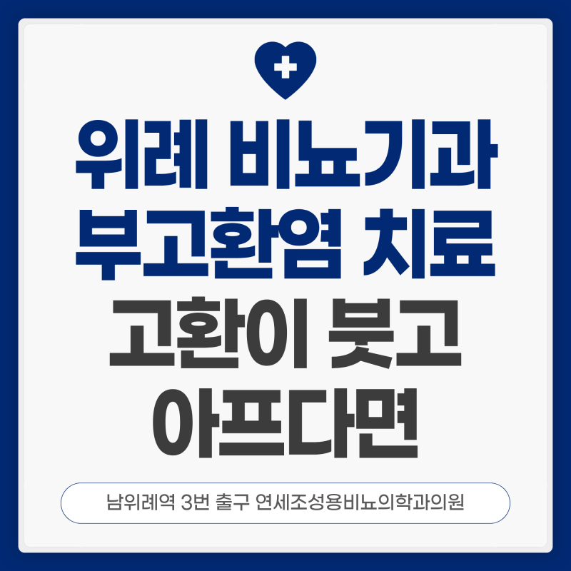 위례 비뇨기과 부고환염 평소보다 부어올랐다면