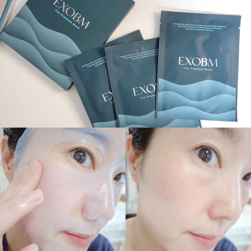 피부진정 마스크팩추천 엑소비엠 식물성엑소좀 마스크팩 사용후기