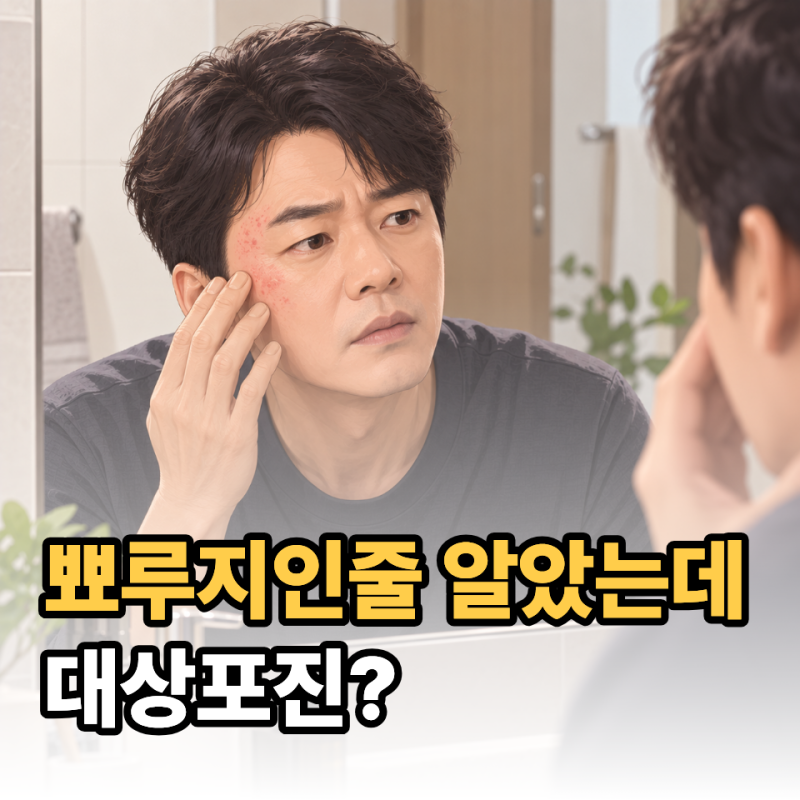 “포크로 얼굴을 긁는 듯했다” 김승수가 고백한 대상포진… 초기증상 4가지