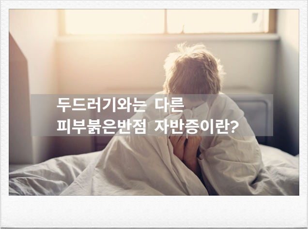 피부붉은반점 혈관염의 일종인 자반증일수도, 자반증 초기증상과 구분법