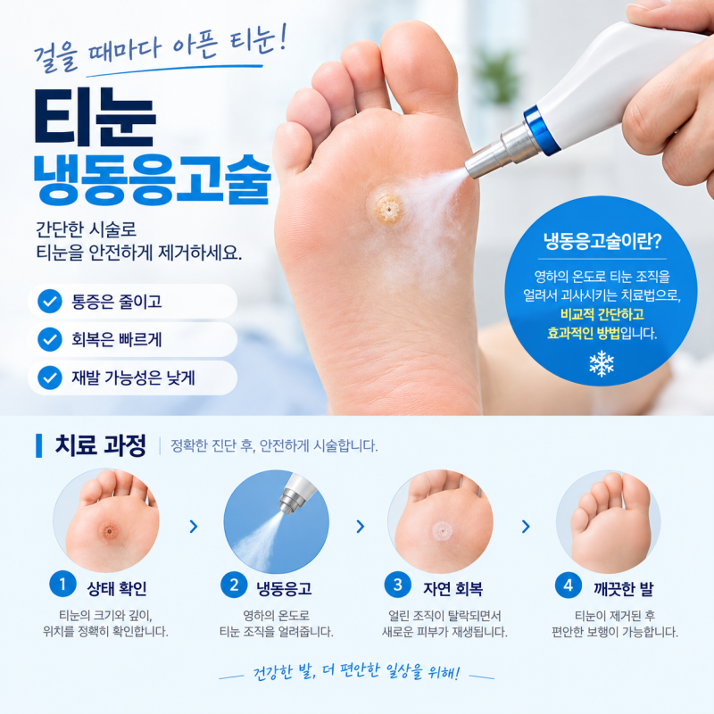티눈 시술 6년간 3,933번? 30억 원 보험금 타낸 사건, 법원 판단은?