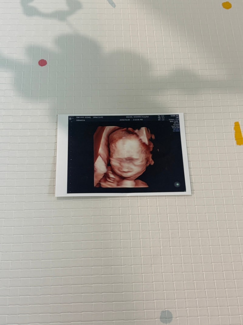 대전 둘째맘이 정리한 2026 산후조리원비 세액공제 + 지역화폐 할인 총정리