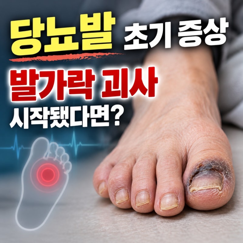 당뇨발 초기 증상 발가락 괴사 시작됐다면?