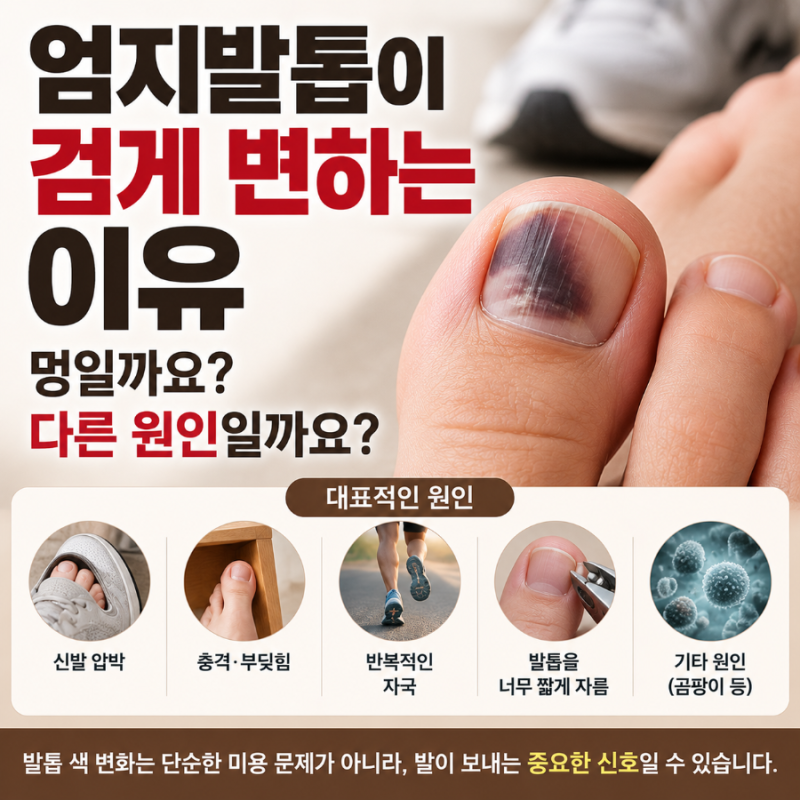 엄지발톱이 검게 변하는 이유, 멍일까요? 다른 원인일까요?