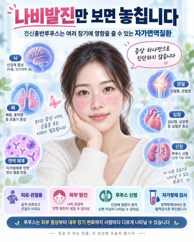 전신홍반루푸스 증상, 얼굴 나비발진만이 아니다…신장·폐·뇌까지 보는 이유