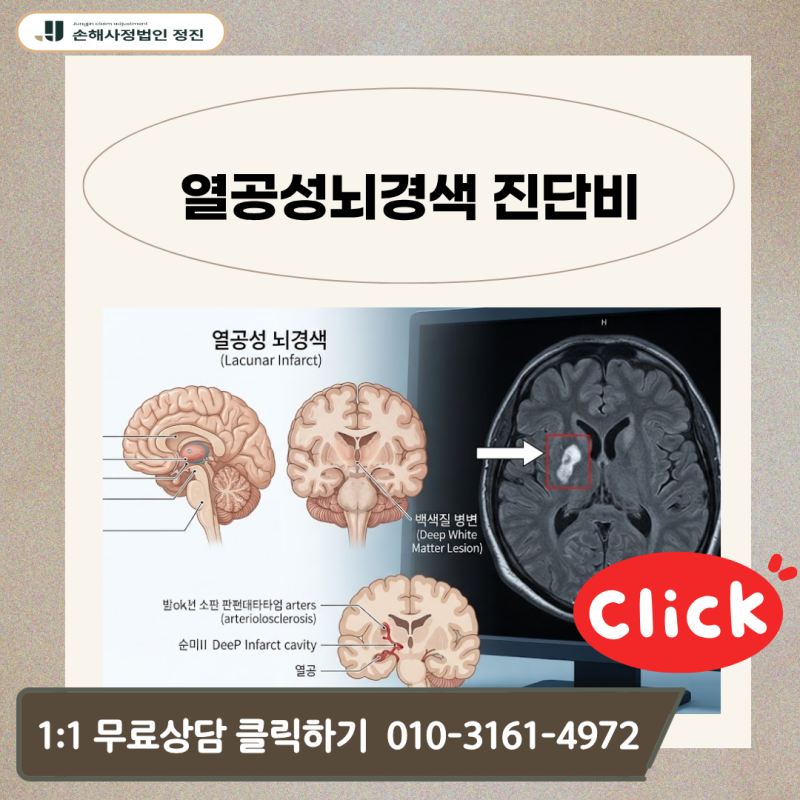 열공성뇌경색 진단비, I63 질병코드 받고도 거절당했다면 어떻게 대응해야 할까?