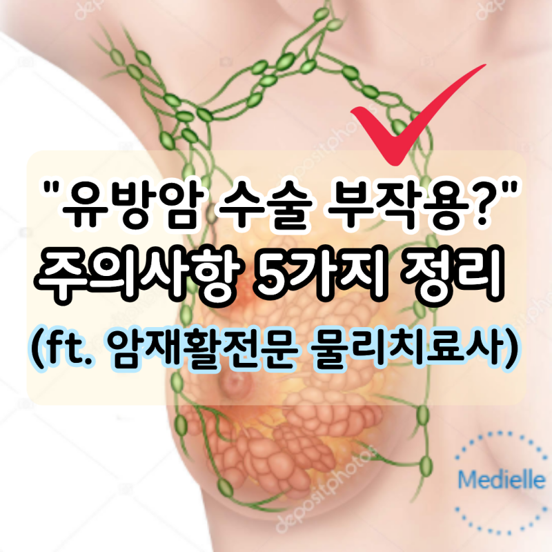 "유방암 수술 후 부작용 5가지" 회복기간과 주의사항은? (ft. 암재활전문 물리치료사)