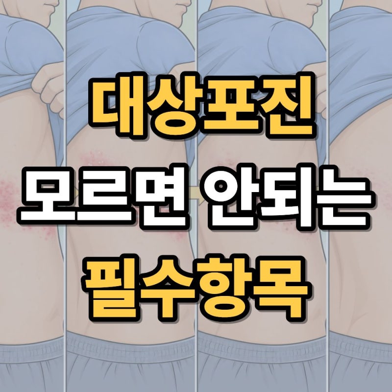 대상포진 모든 것 총정리: 초기증상, 원인, 치료방법, 예방접종, 전염성, 통증