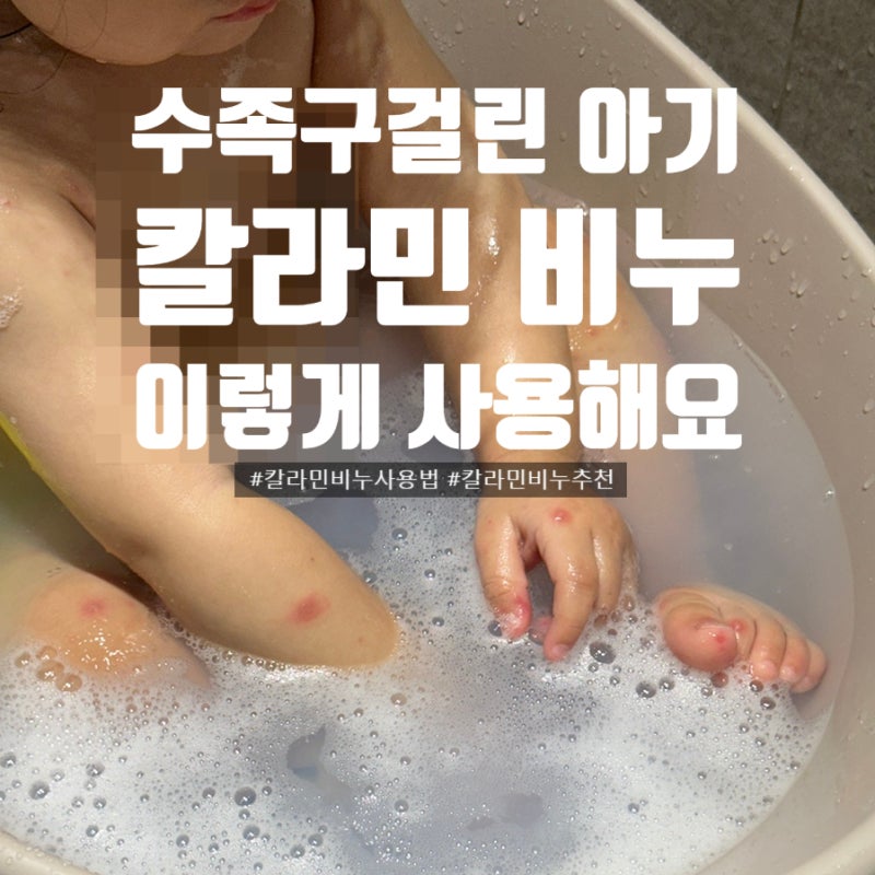 수족구 걸린 16개월 아기 칼라민 비누 사용법｜프롬더랜드 어글리솝 실제 사용 후기