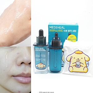 올리브영 추천템, 메디힐 마데카소사이드 수분흔적 세럼 내돈내산 리뷰