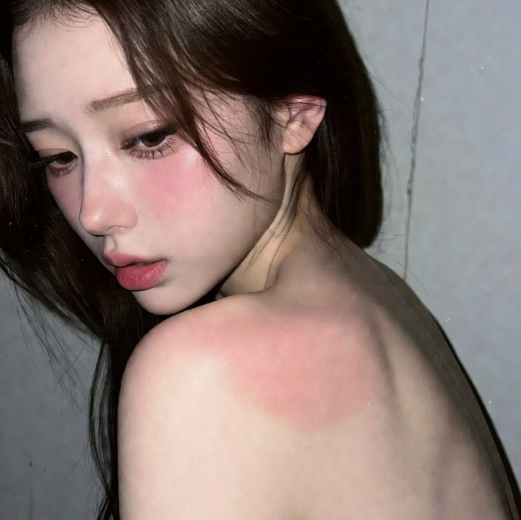 등 대상포진 초기증상 가려움과 근육통 제대로 알아보기