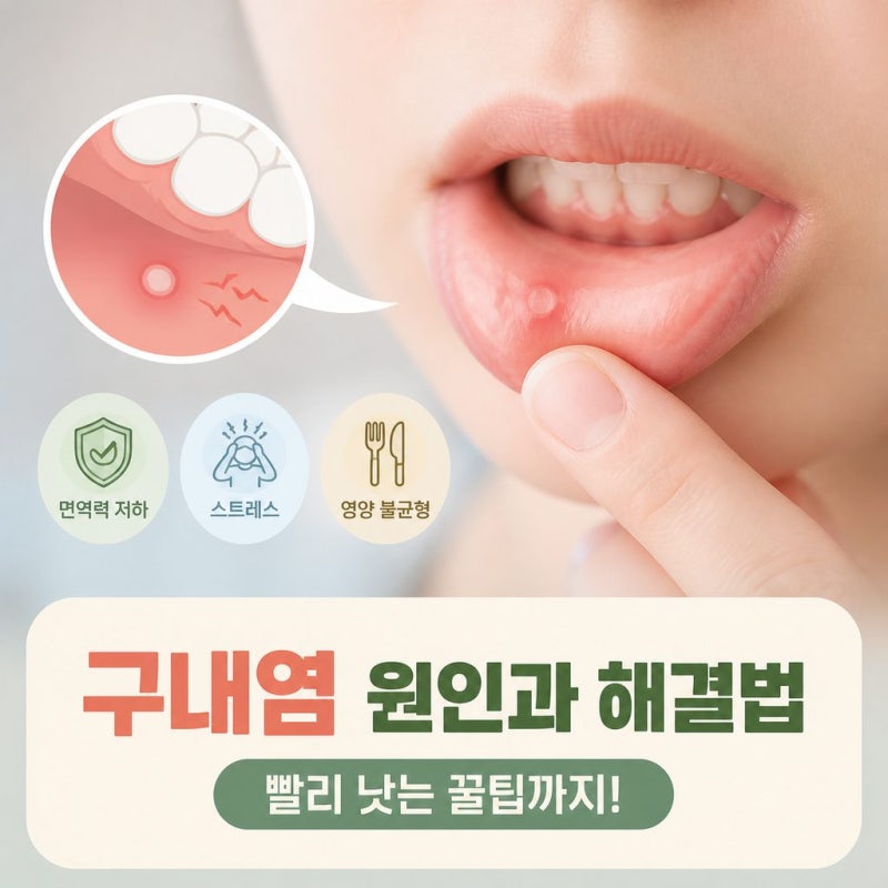구내염 원인부터 빨리 낫는 법까지｜입안이 헐었을 때 알아두세요