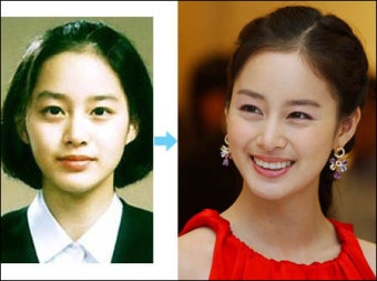 의대 버리고 서울대 선택한 배우 김태희, 전설의 성적표부터 집안까지 진짜 비하인드 5