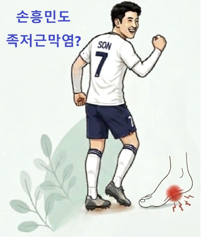 발바닥 통증 왜 자꾸 생길까요? 손흥민도 겪은 족저근막염 총정리
