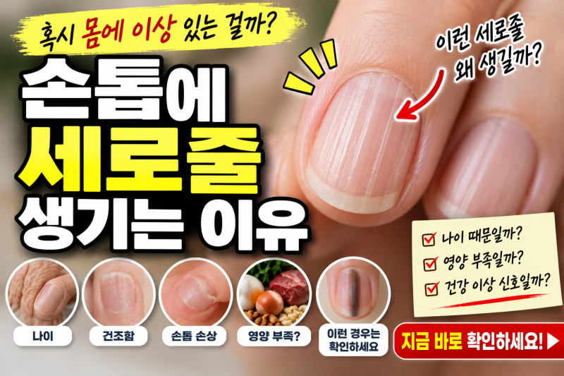 손톱에 세로줄 생기는 이유｜건강 이상 신호일까?