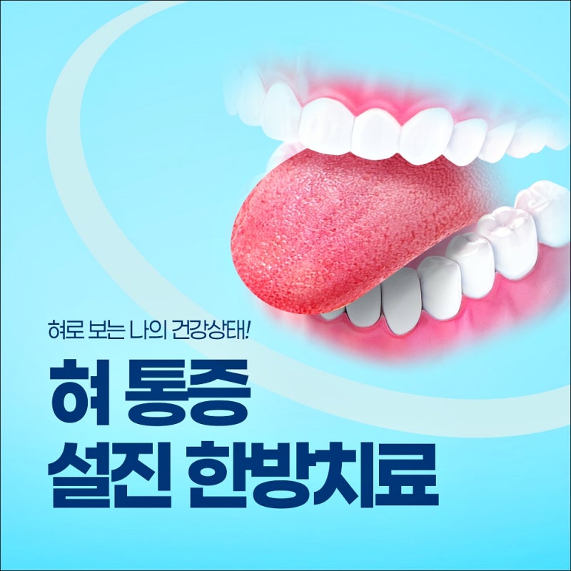 혀통증 병원 찾고 있다면? 아픈 위치와 통증 양상부터 확인하세요