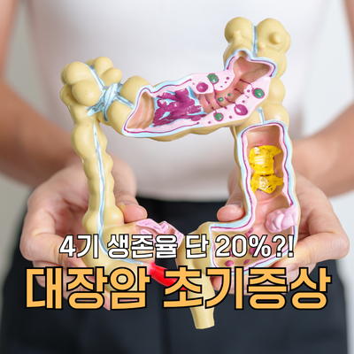4기 생존율 20%? 대장암 초기 전조증상 원인 검사 및 예방법