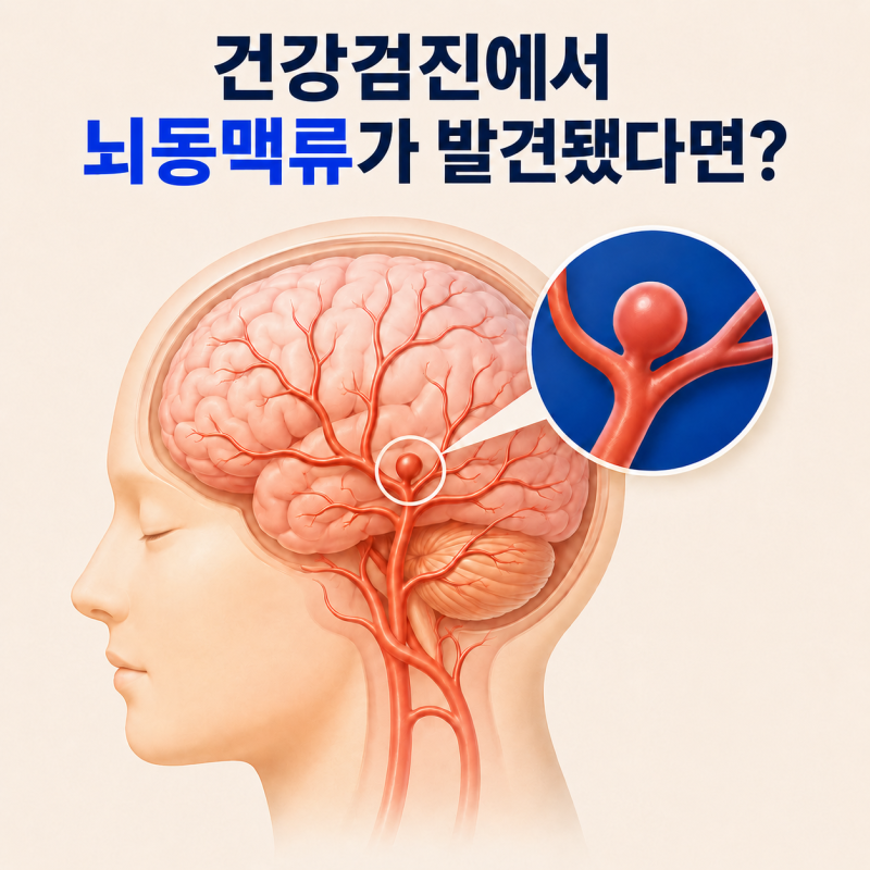 건강검진에서 뇌동맥류가 발견됐다면 보험금 받을 수 있을까?