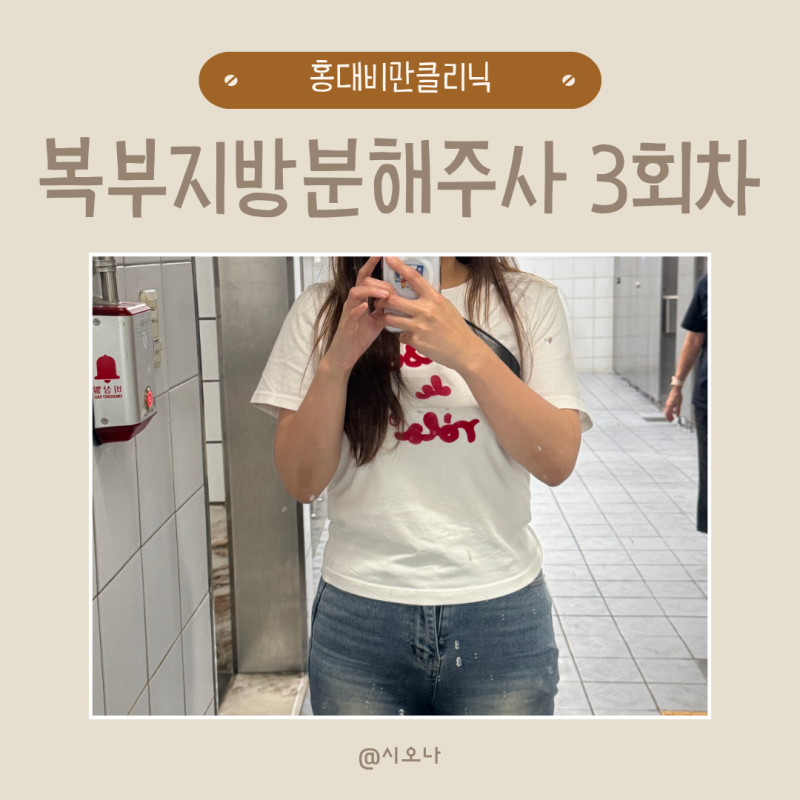 홍대비만클리닉 효과적인 뱃살빼는 방법 복부 제로팻 효과 3회차후기