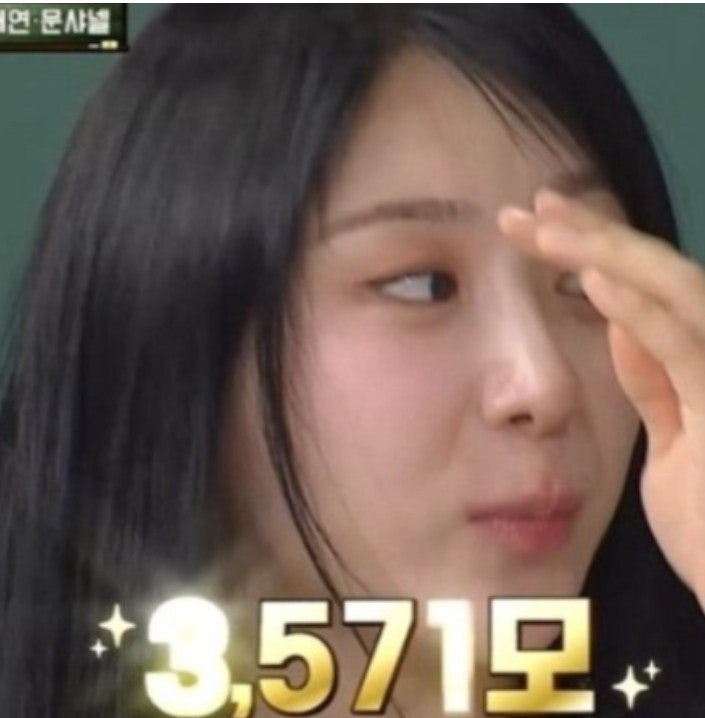 “워터밤에서 흑채 다 씻겨 나갔다더니…” 이채연, 결국 선택했던 ‘3571모 모발이식’
