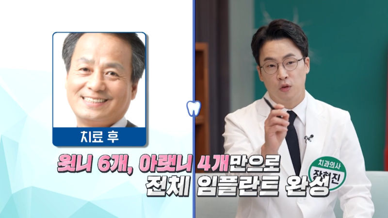 삼성역치과 시니올임플란트, 임플란트를 적게 심는 이유
