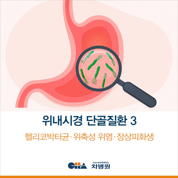 "위암 전 단계?" 위내시경 단골질환 3 (헬리코박터균∙위축성위염∙장상피화생)