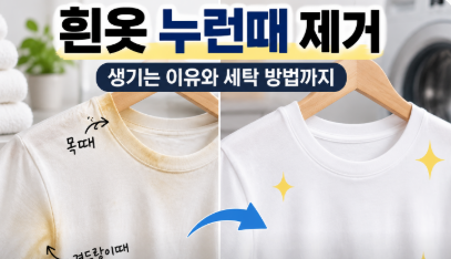 흰옷 누런때 제거, 생기는 이유와 세탁 방법