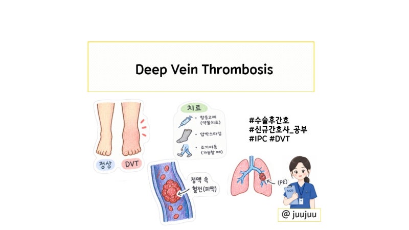 DVT : Deep Vein Thrombosis (심부정맥혈전증), DVT vs Cellulitis 감별