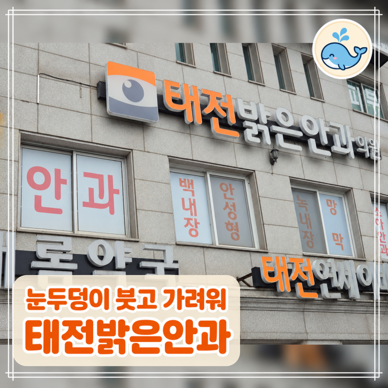 경기광주 태전동 안과 후기｜눈두덩이 붓고 가려워 방문한 태전밝은안과, 화요일 야간진료
