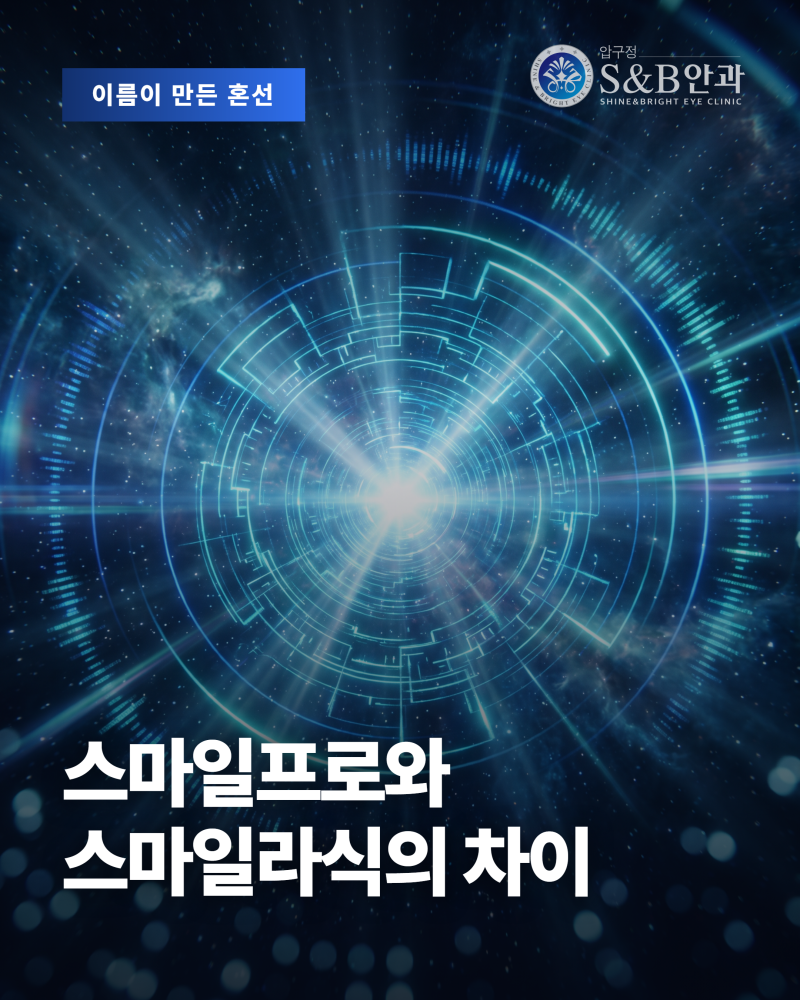 스마일프로라식의 진행 방식과 스마일라식과의 관계