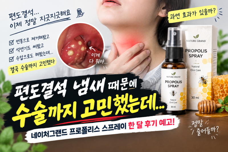 편도결석 때문에 수술까지 고민했다… 마지막으로 프로폴리스 스프레이 써봅니다