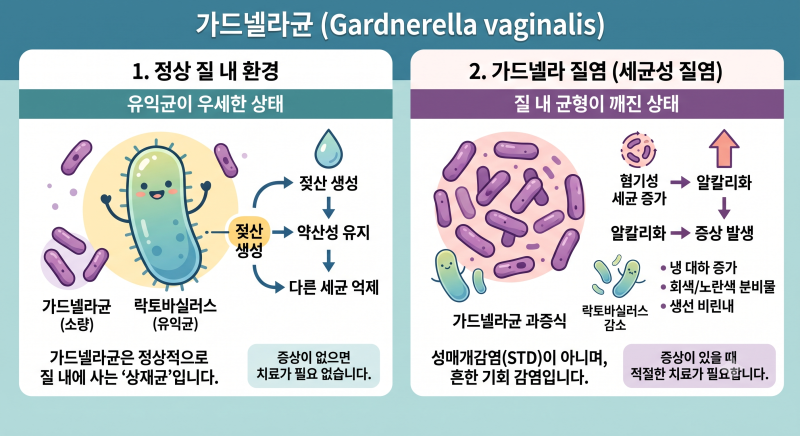 가드넬라 균, 증상은 없는데 괜찮을까요?