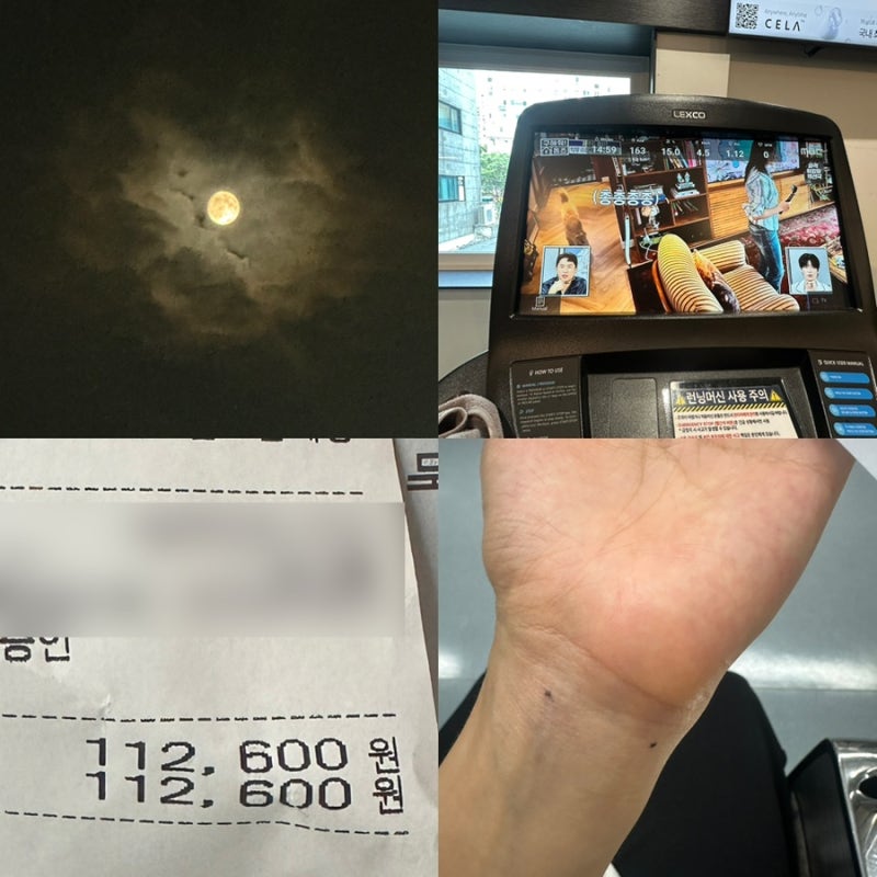 손팔저림 신경과 근전도·신경전도 검사 결과 이상 무~