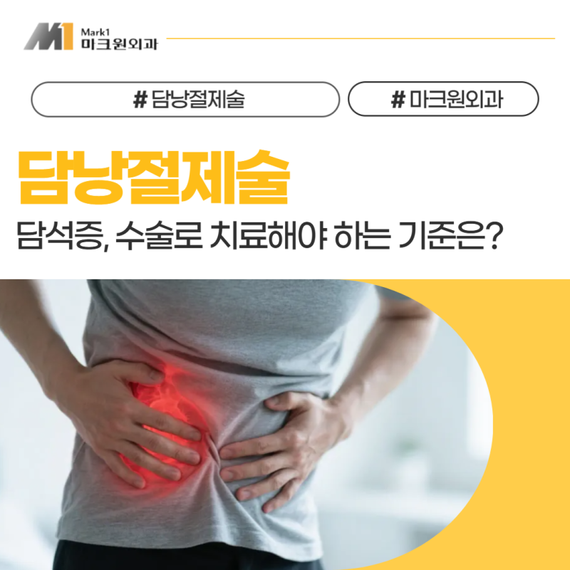 대구 담낭절제술 담석증, 수술로 치료해야 하는 기준은?