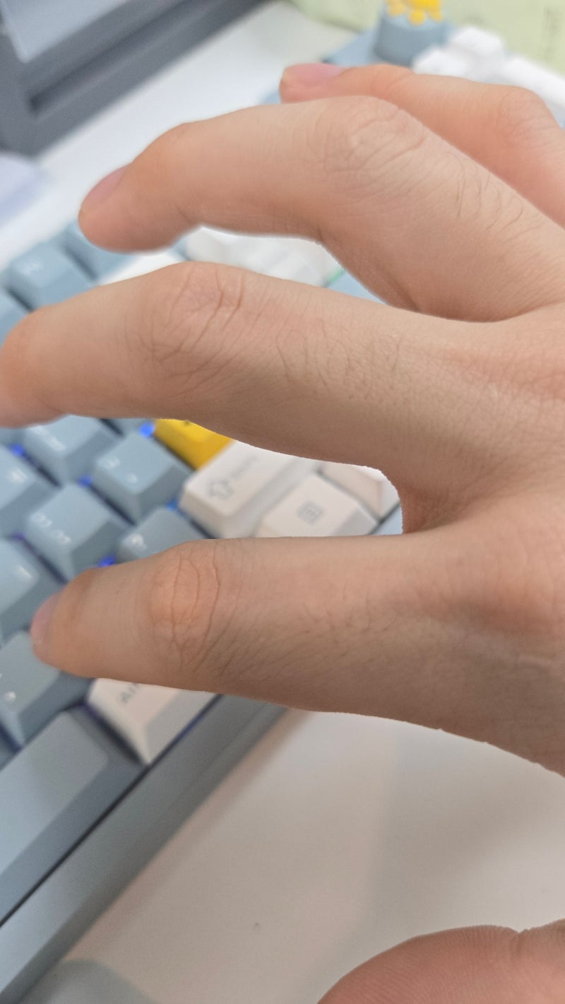예전엔 안아펐는데... 손가락관절염 연골영양제 기준