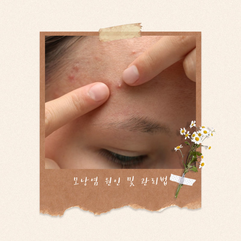 모낭염 증상부터 원인까지, 관리하는 방법은?