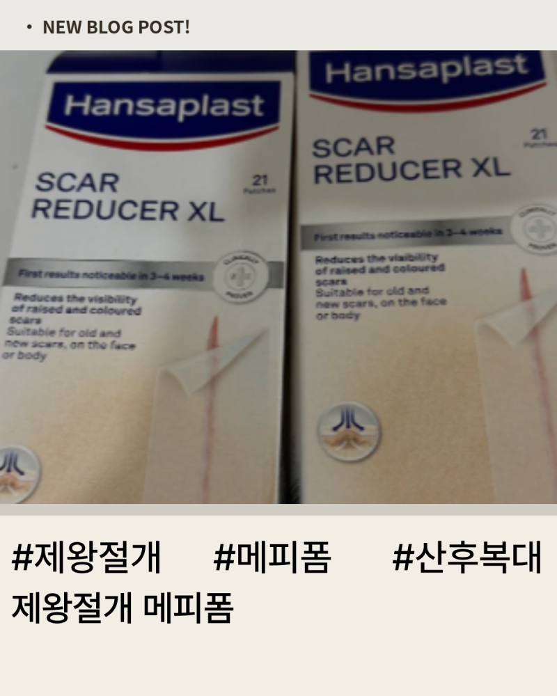 제왕절개 메피폼 사용법 6개월 붙여본 찐후기 총정리