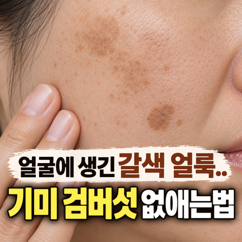 기미 검버섯 없애는법 얼굴에 생긴 갈색 얼룩 차이 구분하기