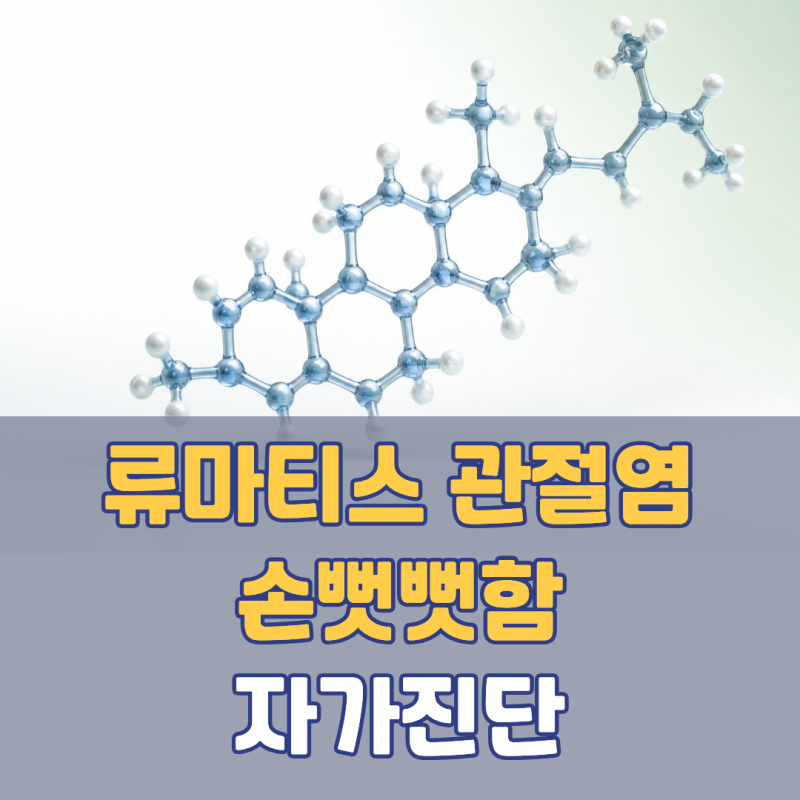 아침마다 손 뻣뻣함 1시간, 류마티스관절염 놓치기 쉬운 신호 | 조조강직 류마티스관절염 자....