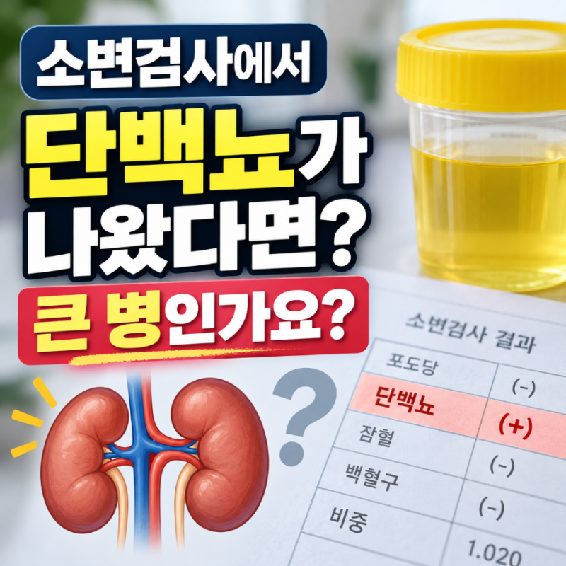 소변검사에서 단백뇨가 나왔다면? 일시적인 경우와 신장질환 구분