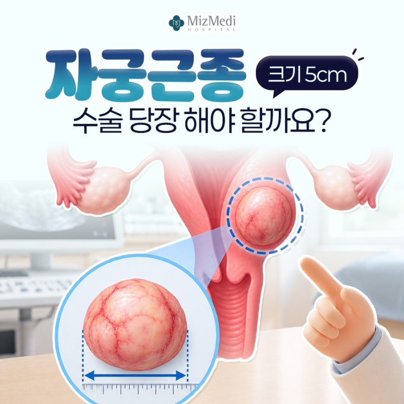 자궁근종 크기 5cm 수술 당장 해야 할까요?