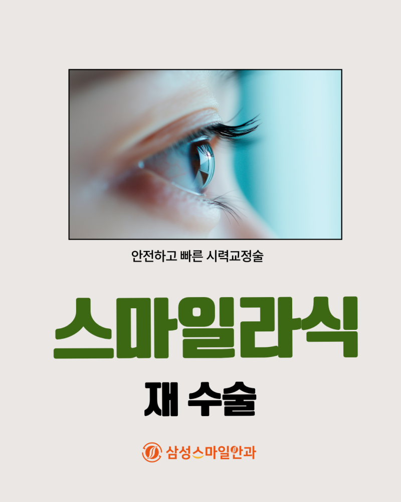 스마일라식 후 시력이 다시 나빠졌어요, 재수술을 받을 수 있을까요?