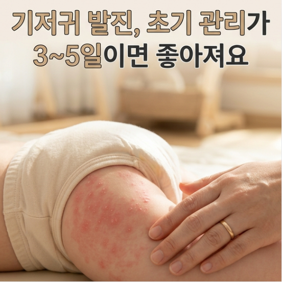 기저귀 발진 응급처치 4단계 | 리도맥스·비판텐·크림 언제 써야 할까?