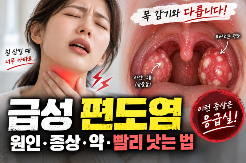 침 삼킬 때 목 통증 '급성 편도염' 응급처치 | 수건 냉/온찜질·이비인후과 수액 및 항생제 복....