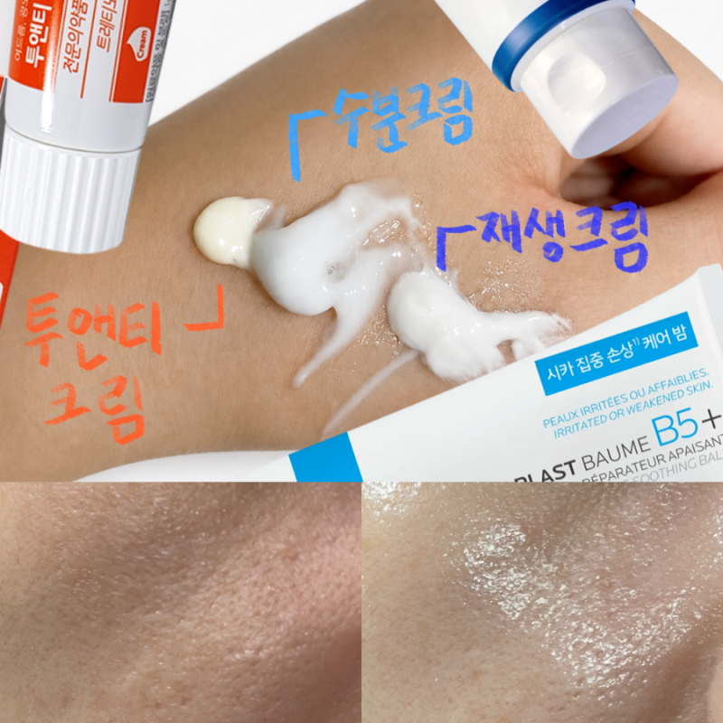 투앤티크림 한달사용후기 | 과연 깐달걀이 됐을까(+전후비교•초근접샷주의, 사용법)