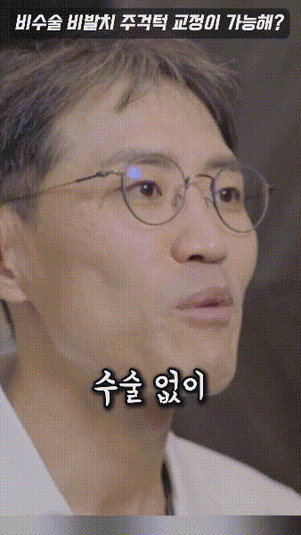 비발치 비수술 성인 주걱턱 교정이 가능한 이유!